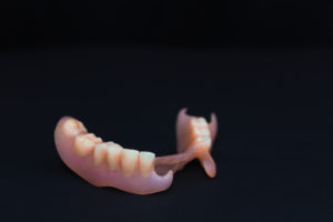 尼崎市　歯医者　アキ歯科クリニック　補綴物　歯の詰め物　ノンクラスプ