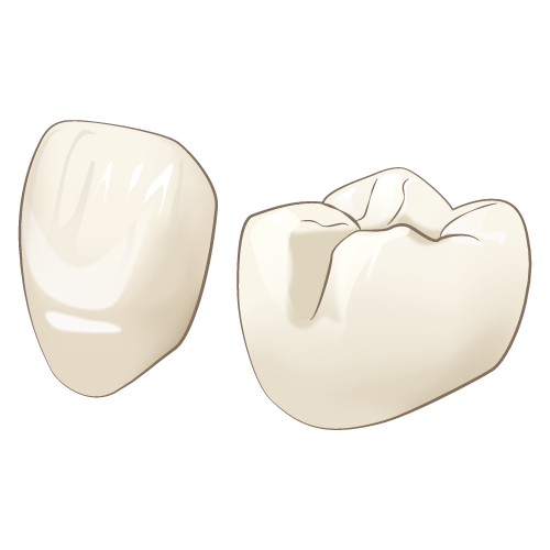 尼崎市 歯医者 アキ歯科クリニック e-maxクラウン