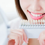 close up of beauty woman smile to you with health teeth and color samples tool for bleaching treatment